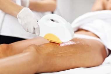 Güzellik kadın bacaklar üzerinde epilasyon lazer tedavisi veren