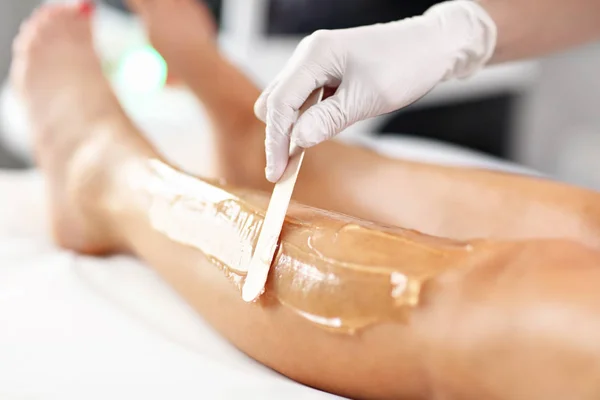 Kosmetikerin behandelt Frau mit Epilationslaser an den Beinen — Stockfoto