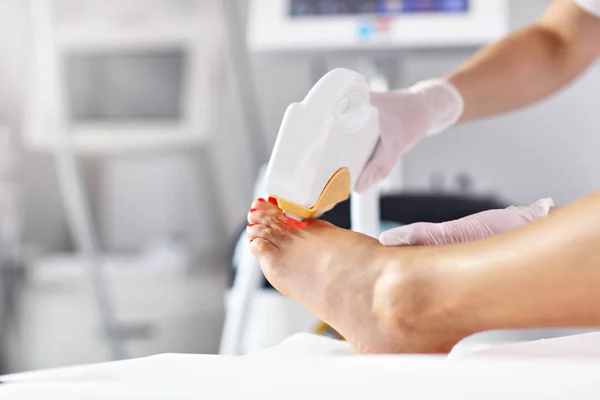 Αισθητικός δίνοντας αποτρίχωση θεραπεία με λέιζερ στη γυναίκα στα πόδια — Φωτογραφία Αρχείου