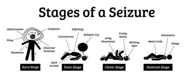 Stages and phases of a seizure. Illustrations depicts the phases when a person get a seizure which are the aura, tonic, clonic, and postictal stages. clipart