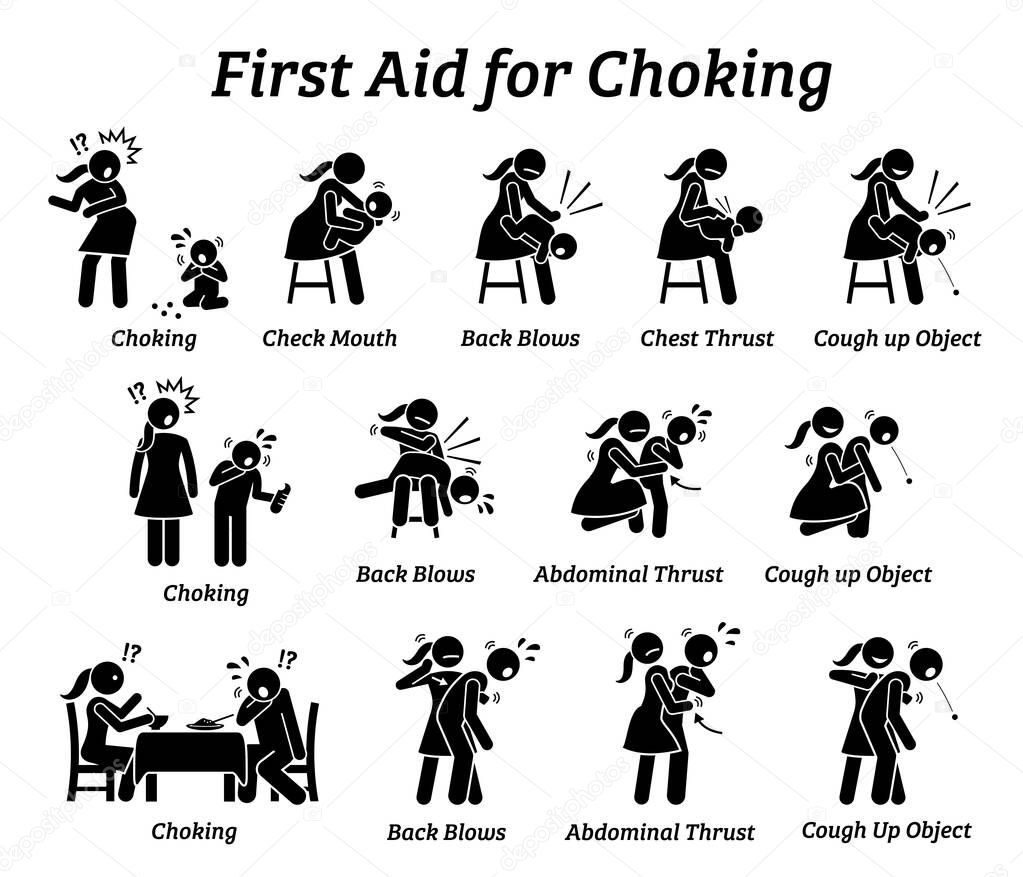 First aid emergency treatment for choking stick figures icon. Vector illustrations of baby, child, and adult choking while getting rescued with Heimlich Maneuver method.