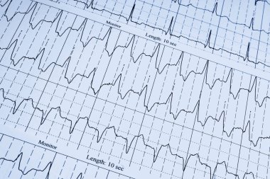 kardiyogram arka plan üzerinde kalp atışı ile yakın çekim