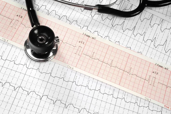 kardiyogram arka planda stetoskop