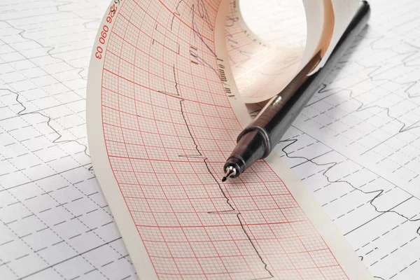 Kardiyogram Arka Plan Üzerinde Kalp Atışı Ile Yakın Çekim — Stok fotoğraf