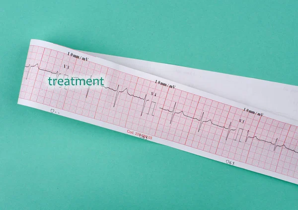 Ecg Sobre Fundo Verde Ciano — Fotografia de Stock