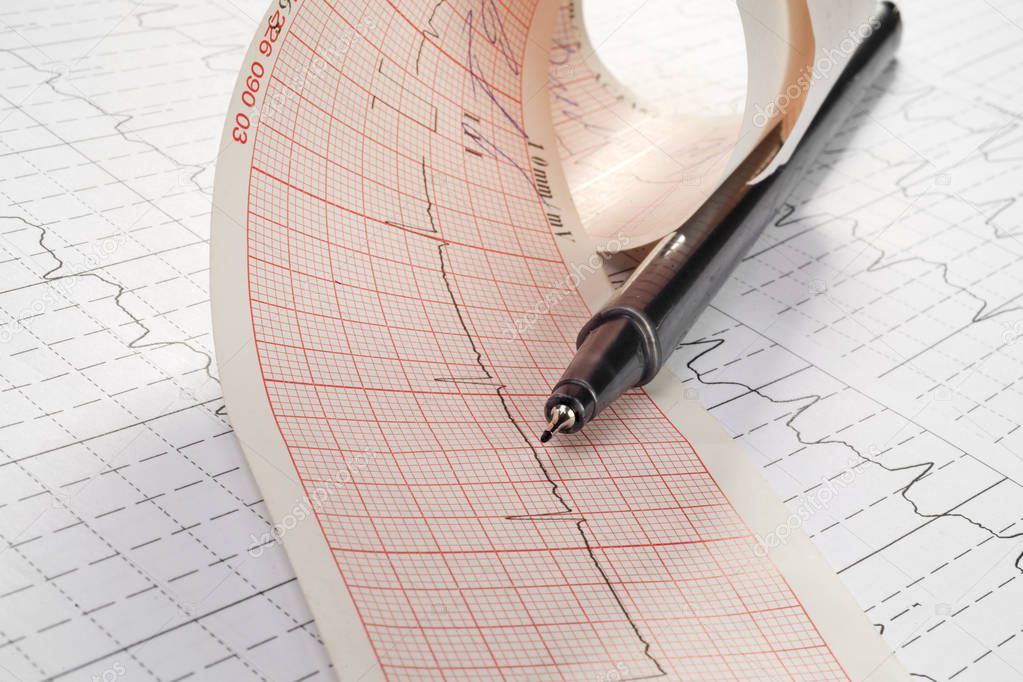 cardiogram with heartbeat  on background,close up
