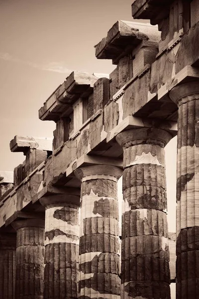 Colonne Primo Piano Veduta Delle Rovine Storiche Dell Acropoli Atene — Foto Stock