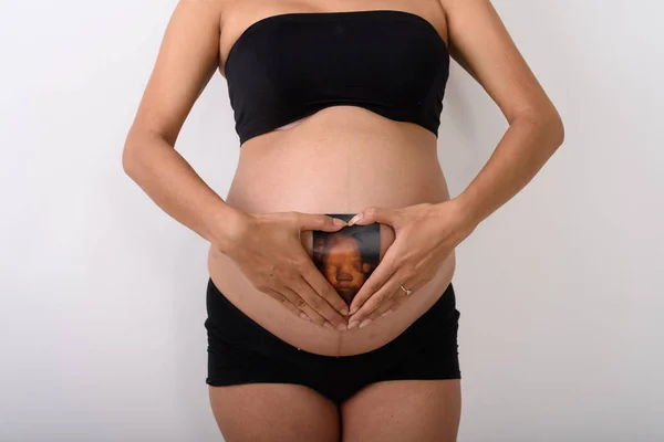 Asiática embarazada sosteniendo sonograma de su bebé — Foto de Stock