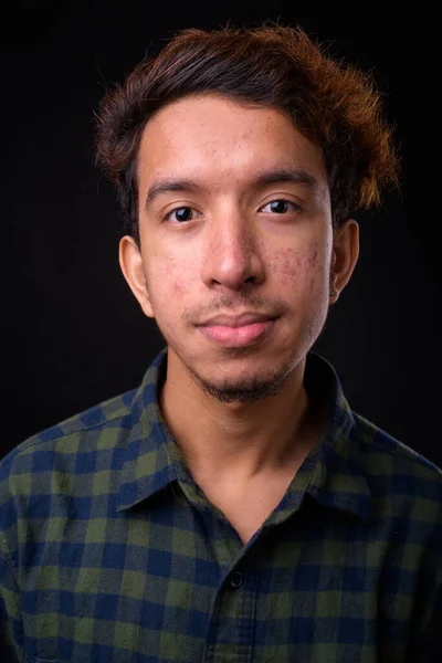 Estúdio Tiro Jovem Asiático Hipster Homem Com Cabelo Encaracolado Acne — Fotografia de Stock