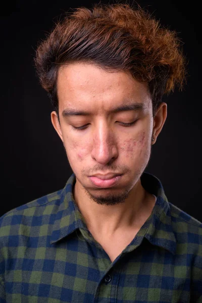 Estudio Disparo Joven Asiático Hipster Hombre Con Pelo Rizado Acné —  Fotos de Stock