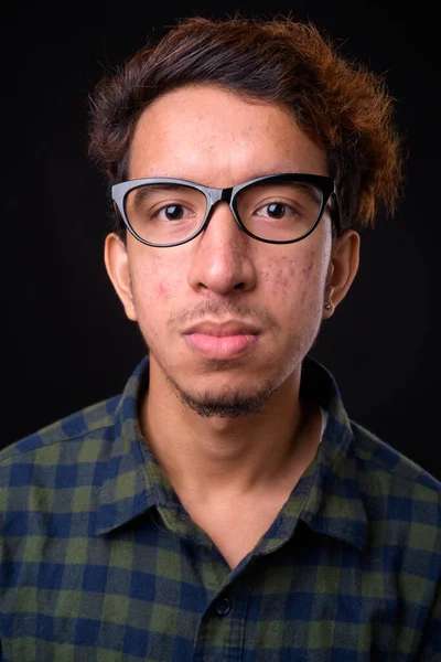 Estudio Disparo Joven Asiático Hipster Hombre Con Pelo Rizado Acné —  Fotos de Stock