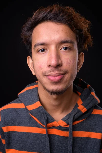 Estúdio Tiro Jovem Asiático Com Cabelo Encaracolado Acne Usando Capuz — Fotografia de Stock