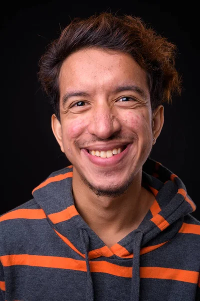 Studio Shot Young Asian Man Curly Hair Acne Wearing Hoodie — Stock Photo, Image