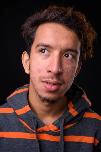 Estúdio Tiro Jovem Asiático Com Cabelo Encaracolado Acne Usando Capuz — Fotografia de Stock