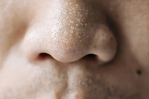 Close up of sweating water drop on the skin