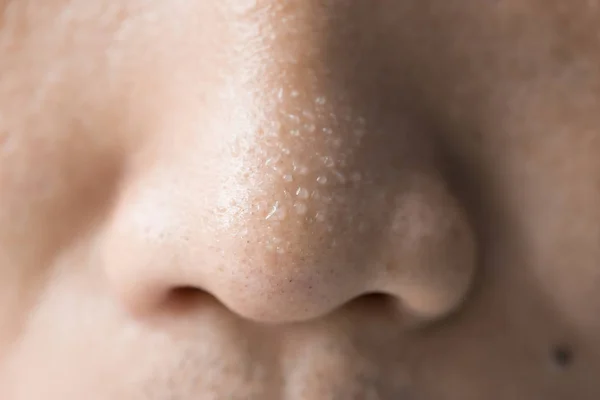 Close Sweating Water Drop Skin — Stock Photo, Image