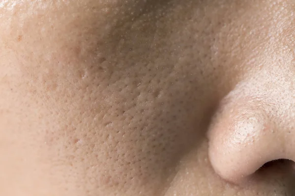 Freckles Asian Face Skin Problems — Stock Photo, Image