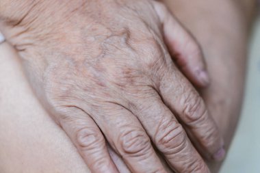 Yaşlı kadının elinde kırışıklık ve damarlar var..