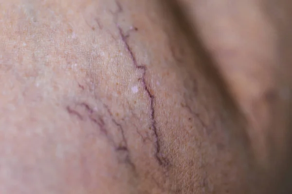 40+ Mastectomy Scar Stock Photos, Pictures & Royalty-Free Images