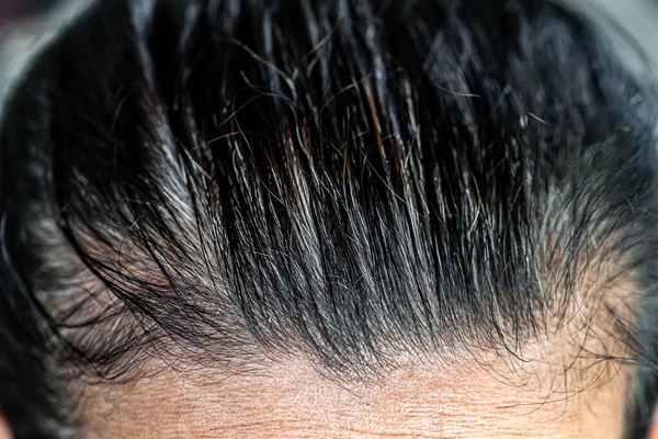 Graue Haare Bei Alten Frauen — Stockfoto