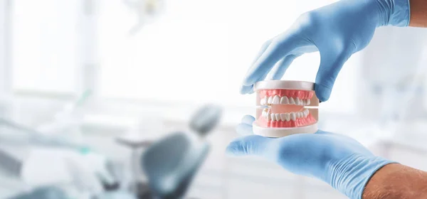 Tandläkare händer med tand modell i Dental Clinic — Stockfoto