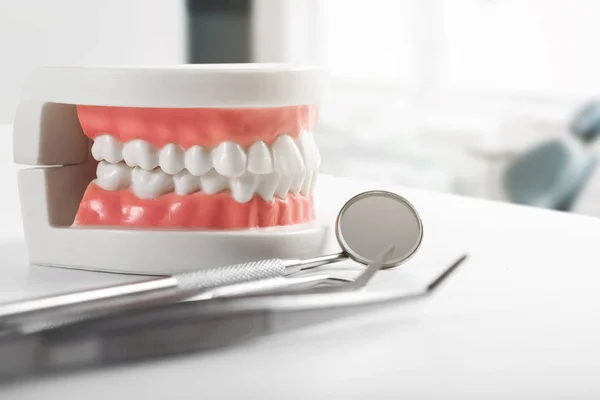 Modelo de dente e ferramentas odontológicas na mesa em consultório odontológico — Fotografia de Stock