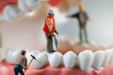 diş tedavi konsepti - diş modeli üzerinde inşaat işçilerin minyatür heykelcikler