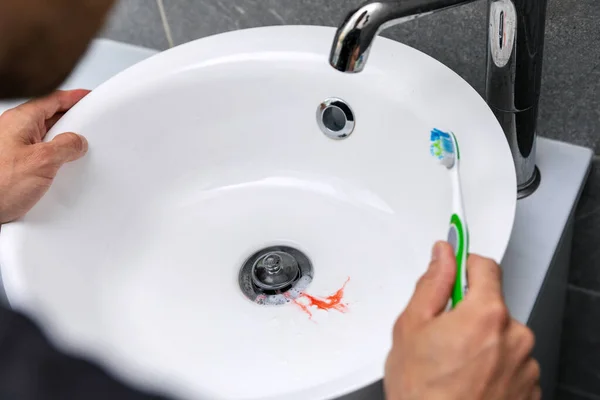 Homem Tem Sangramento Gengiva Enquanto Escova Dentes Cárie Dentária Conceito — Fotografia de Stock