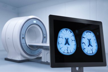 3D işleme bilgisayar monitör ekran x-ışını beyin MR'ı La