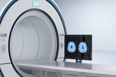 3d rendering computer monitor display x-ray brain in mri la clipart