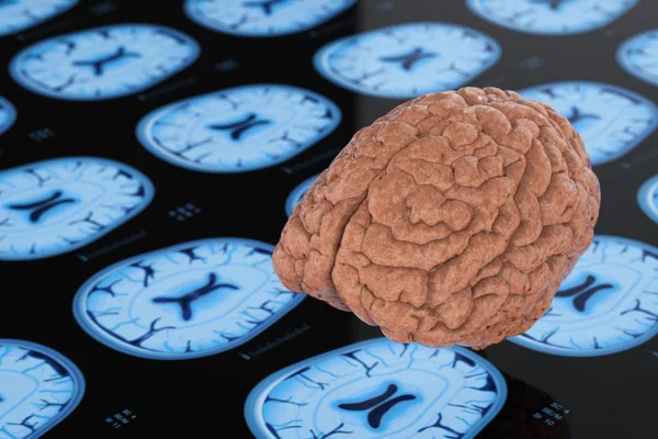 射线脑背景绘制人脑 — 图库照片