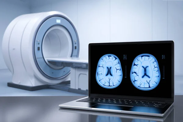 Візуалізація Комп Ютерного Ноутбука Відображення Рентгенівського Мозку Mri — стокове фото