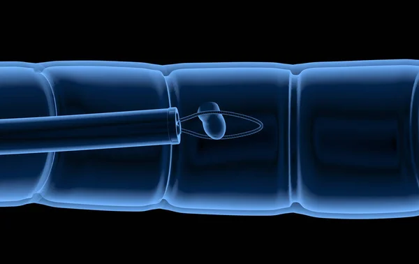 X-stråle polyp flyttande — Stockfoto