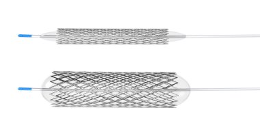 Balon anjiyoplasti için stent 