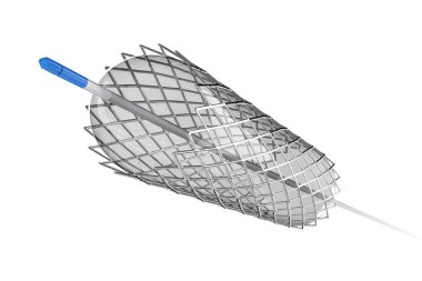 Balon anjiyoplasti için stent 