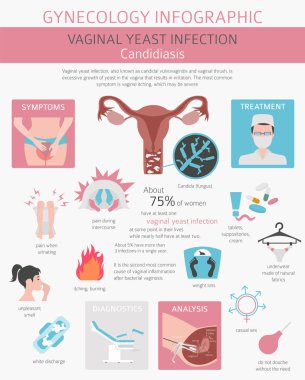 Vajinal mantar enfeksiyonu. Kandidiyazis. Ginecological tıbbi desease Infographic. Vektör çizim