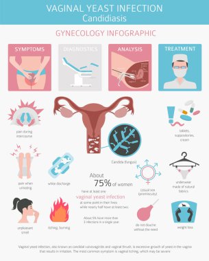 Vajinal mantar enfeksiyonu. Kandidiyazis. Ginecological tıbbi desease Infographic. Vektör çizim