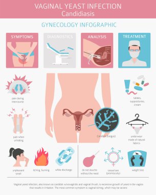 Vajinal mantar enfeksiyonu. Kandidiyazis. Ginecological tıbbi desease Infographic. Vektör çizim