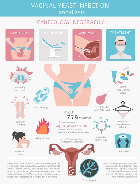 Infección Vaginal Por Levaduras Candidiasis Infografía Ginecológica Enfermedades Médicas Ilustración — Vector de stock