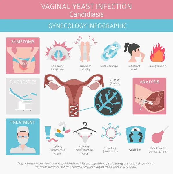 Infección Vaginal Por Levaduras Candidiasis Infografía Ginecológica Enfermedades Médicas Ilustración — Vector de stock