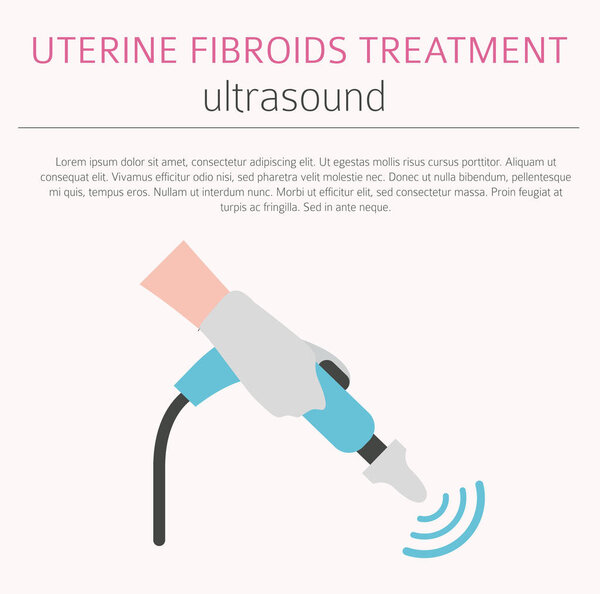 Uterine fibroids. Ginecological medical desease in women infographic. Vector illustration
