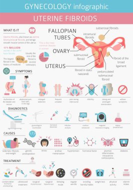 Uterin fibroids. Ginecological tıbbi desease kadınlar Infographic içinde. Vektör çizim