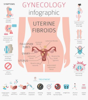 Uterin fibroids. Ginecological tıbbi desease kadınlar Infographic içinde. Vektör çizim