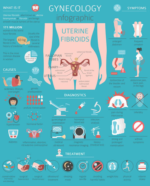 Uterine fibroids. Ginecological medical desease in women infographic. Vector illustration