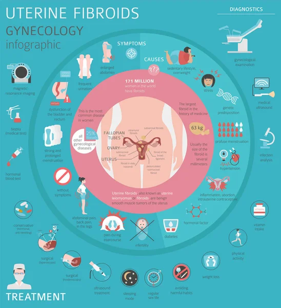 Fibromi Uterini Malattia Medica Ginecologica Nelle Donne Infografica Illustrazione Vettoriale — Vettoriale Stock