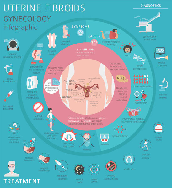 Uterine fibroids. Ginecological medical desease in women infographic. Vector illustration