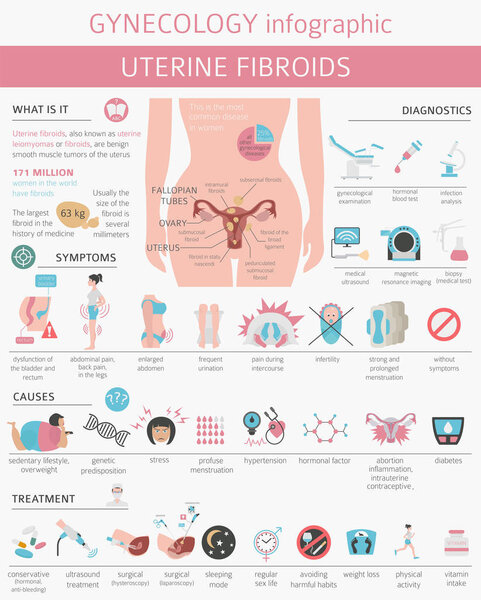 Uterine fibroids. Ginecological medical desease in women infographic. Vector illustration