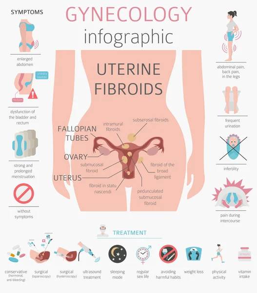 Miomas Uterinos Doença Médica Ginecológica Mulheres Infográfico Ilustração Vetorial — Vetor de Stock