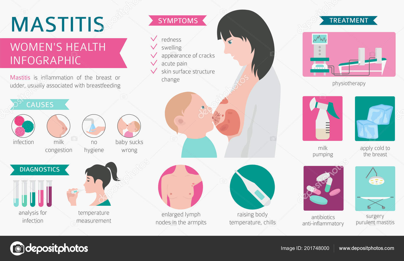 Mastitis durante la lactancia Qué es y cómo tratarla Etapa Infantil Sexiz Pix