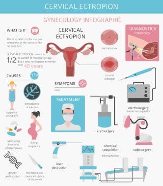 Servikal ectropion. Ginecological tıbbi desease Infographic. Vektör çizim